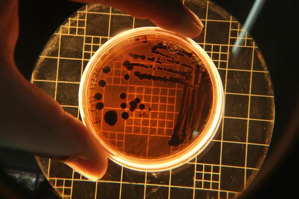 Petri dish with bacterial culture under a telescope