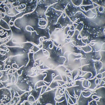 Microscopic view of numerous insect-parasitic nematodes used in UCR research on biological pest control and crop protection.